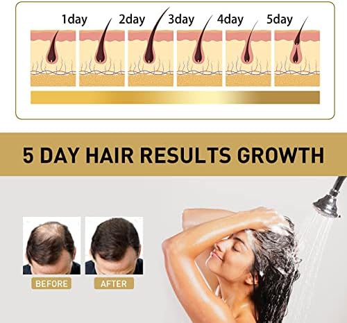 Zadebljanje opadanje deblje ženske kose ubrzava regenerator za kosu-9100 inča šampon za kosu potiče rast i šampon za muškarce za potpuniju